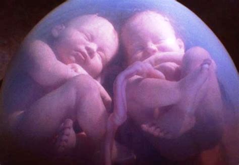 cómo quedar embarazada de gemelos con estos trucos sencillos medicina sana