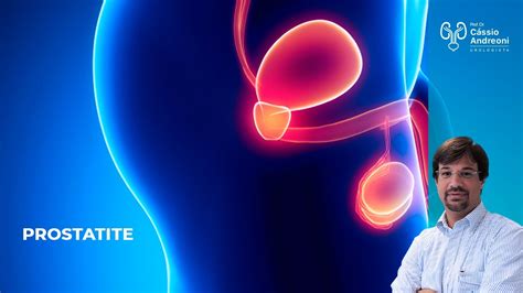 Prostatite Causas Sintomas Exames E Tratamentos Dr Cassio