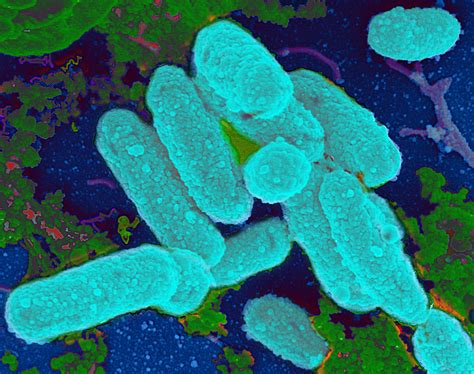 Scientists Find Link Between Antibiotics And Bacterial Biofilm