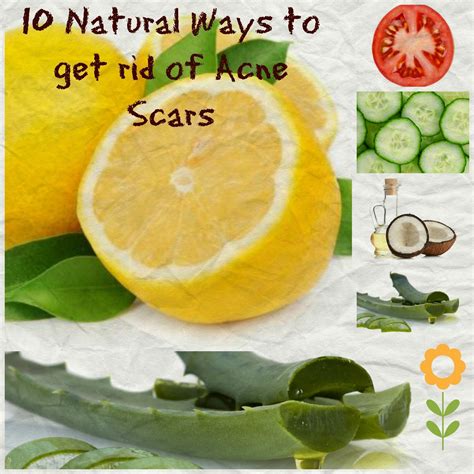 10 Natural And Cheap Ways To Remove Acne Scars