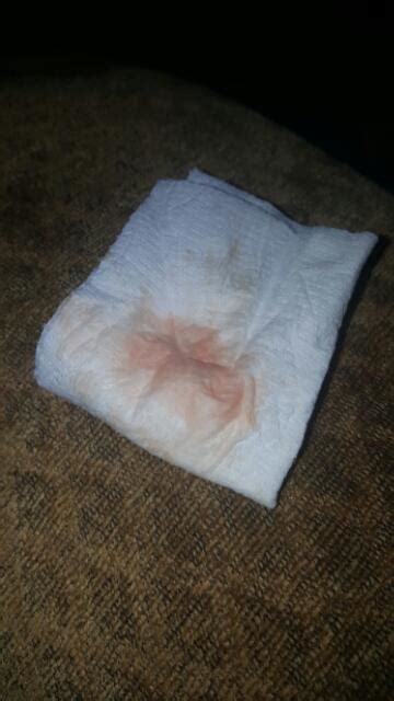 Does This Look Like Implantation Bleeding Its Looked Like This All