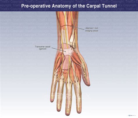 Pre Operative Anatomy Of The Carpal Tunnel Trial Exhibits Inc