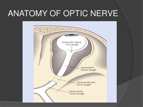 Traumatic Optic Neuropathy