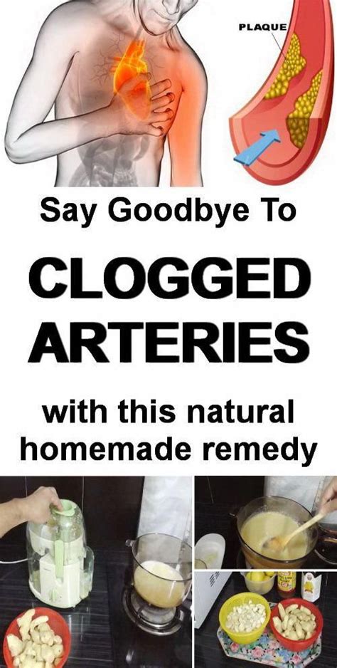Homemade Remedy For Clogged Arteries That You May Try Cloggedarteries