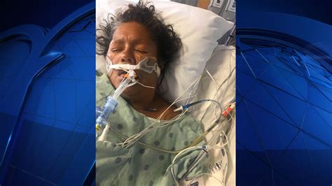 Hit And Run Leaves Fort Worth Woman In Critical Condition Nbc 5