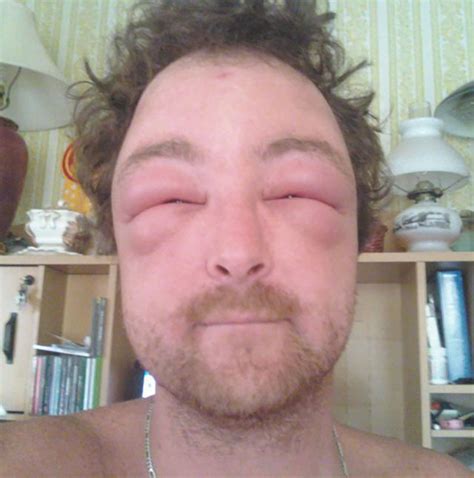 Allergic Reaction Faces Caveman Circus Caveman Circus