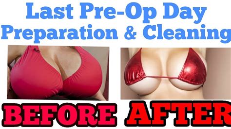 Breast Reduction Process Last Pre Op Day Preparation Part 3 Youtube