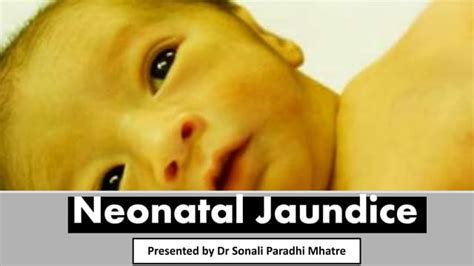 Neonatal Jaundice Final Ppt