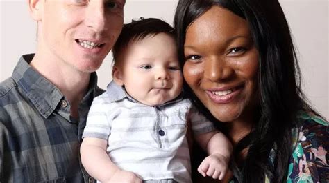 How A White Baby Can Be Born To A Black Mother The Statistics Of Skin