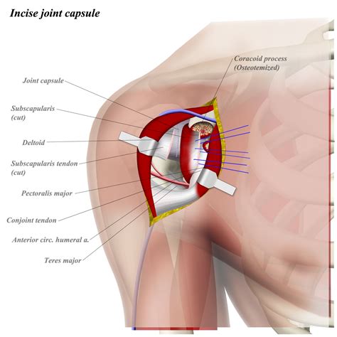 Test your knowledge in our quiz about the shoulder muscles. Shoulder Muscles Diagram Anterior / Muscles Of The ...