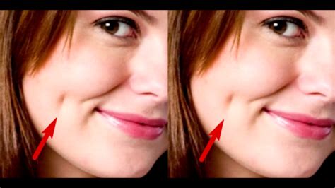 Язвины (на листах при их прилипании). Here Is The Meaning Of The Dimples On The Cheeks