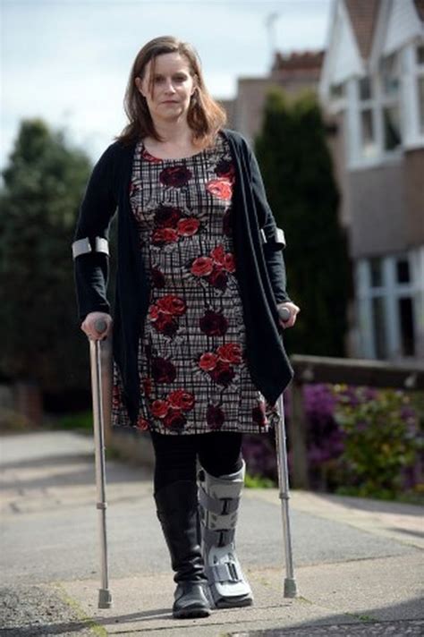 Woman With Legcast On Crutches Fashion Women Style