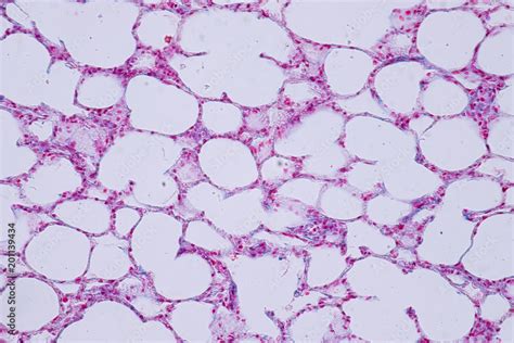 Human Lung Tissue Under Microscope View For Education Histology Stock