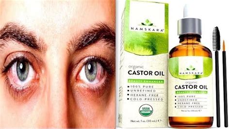 Remove Cataract Without Surgery And Improve Eyesight Fully With Castor Oil Youtube