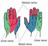Pictures of Can A Pinched Nerve Cause Skin Sensitivity