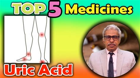 Top 5 Homeopathy Medicines For Uric Acid Dr P S Tiwari Youtube