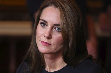 Ne Status Ne Bogastvo Ji Ne Pomagata Kate Middleton Ima Redko Bolezen