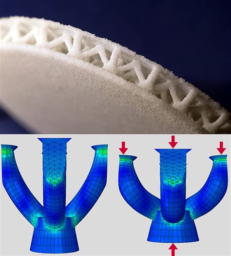 3d Printed Shoe Insoles To Save Diabetic Feet Medgadget