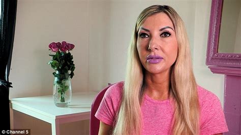 Mum Spent £20000 On Botox Breast Implants And Fillers To Look Like