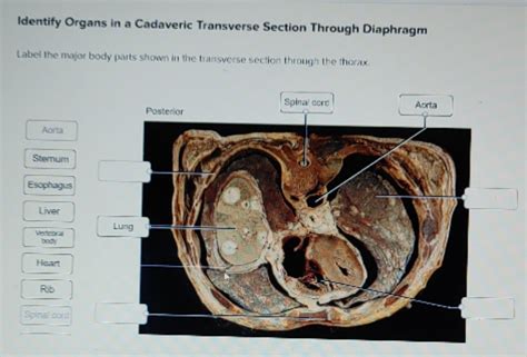 Solved Label The Major Body Parts Shown In The Transverse Section