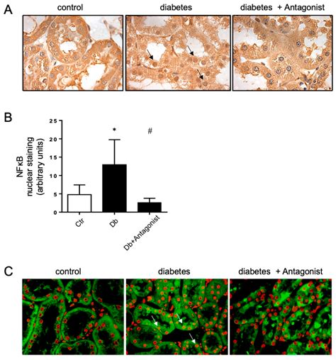 Ijms Free Full Text Blockade Of The Adenosine A3 Receptor