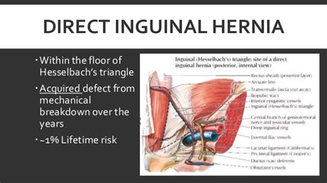 My conclusion is that indirect is incarcerated and direct is strangulated. Inguinal hernia