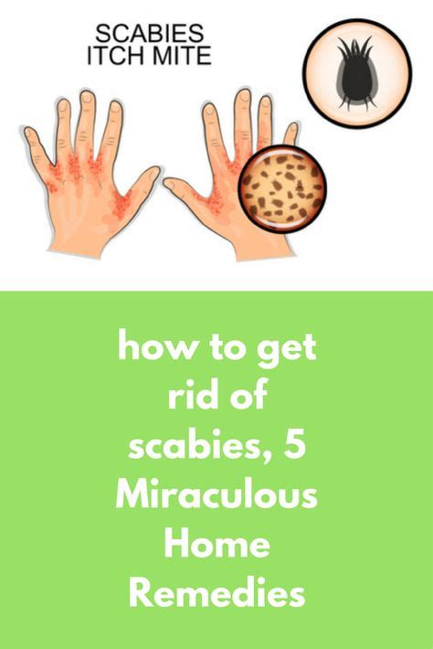28 Best Rashes Remedies Ideas In 2021 Rashes Remedies Scabies