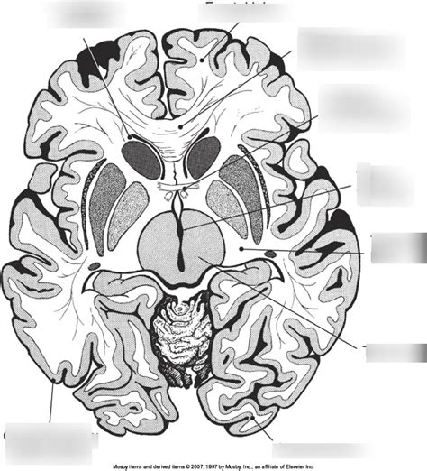 Axial View Of Cerebral Cortex And Corpus Callosum Diagram Quizlet