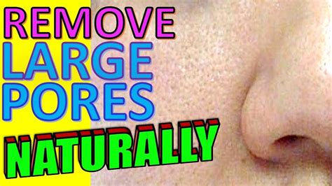 How To Eliminate Large Pores With Simple Home Remedies Youtuberandom