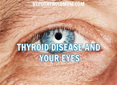 Hypothyroid Mom Page 2 Of 43 Hypothyroidism Thyroid Disease
