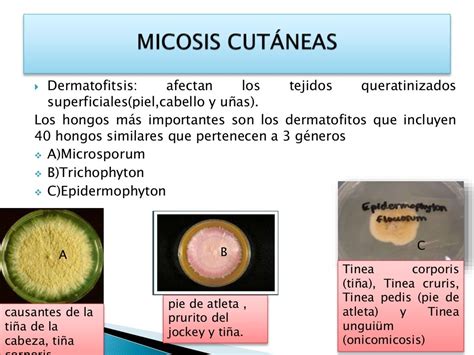 Morfología Microscópica Y Macroscópica De Los Hongos