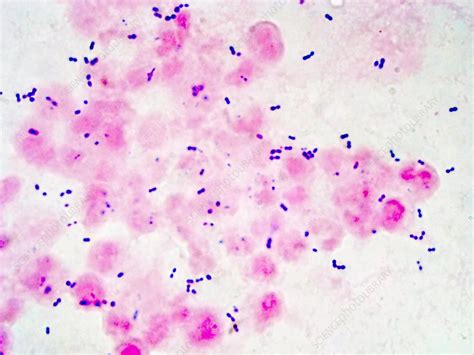 Streptococcus Pneumoniae Under Microscope