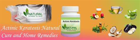 10 Actinic Keratosis Natural Cure And Home Remedies