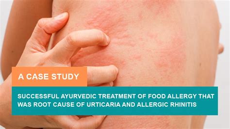 Successful Ayurvedic Treatment Of Food Allergy Urticaria And Allergic