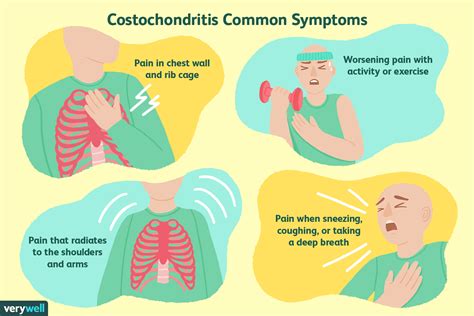 What Is Costochondritis What Are The Symptoms Of Costochondritis