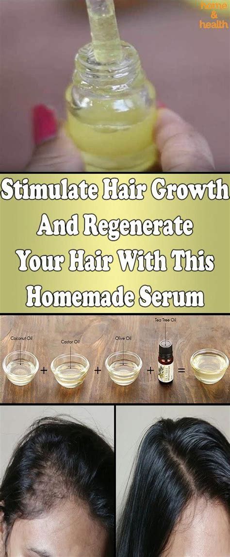 Restoring such deficiencies by supplementing these vitamins may help restore hair growth (1). With the help of this remedy you can expect hair growth ...