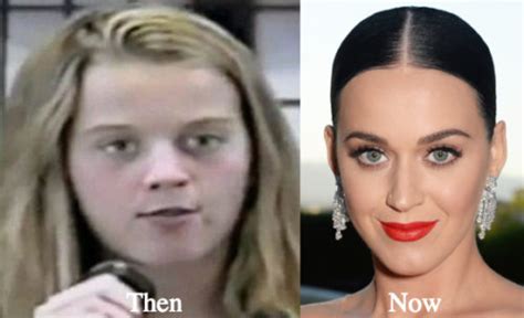 Katy Perry Plastic Surgery Before And After Photos