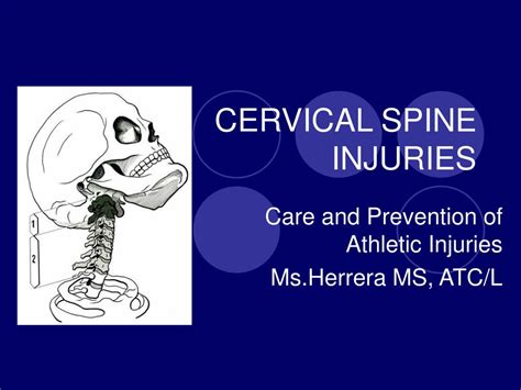 Ppt Cervical Spine Injuries Powerpoint Presentation Free Download