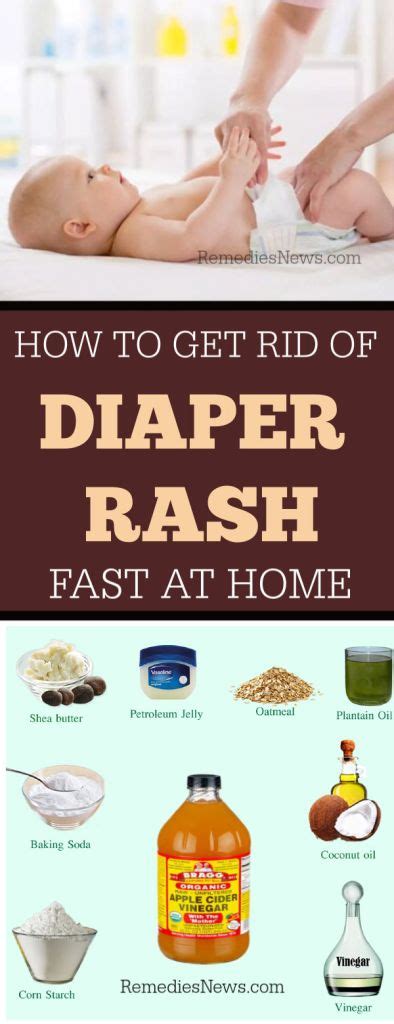 11 Natural Remedies To Get Rid Of Diaper Rash In 24 Hours
