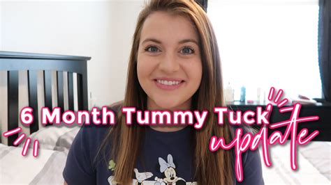 6 Month Tummy Tuck Surgery Update Youtube