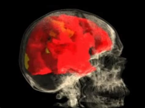 Video Shows The Female Brain During Orgasm