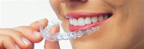 Aparelho De Ortodontia Invisalign Siga Odontologia