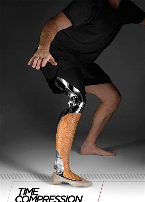 Orthotics And Prosthetics Prosthetic Leg Prosthetics