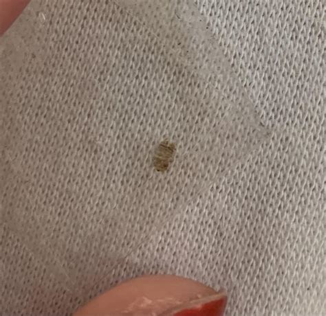 Bed Bugs Or Carpet Beetle Casing Bedbugs