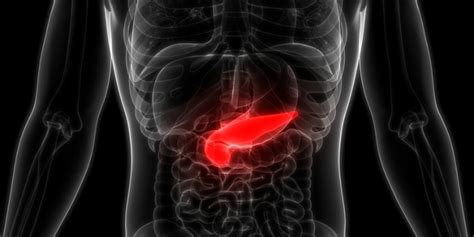 Todavia, na doença crônica a dor é recorrente e não desaparece após alguns dias. Pancreatitis: qué es, síntomas, prevención y tratamiento