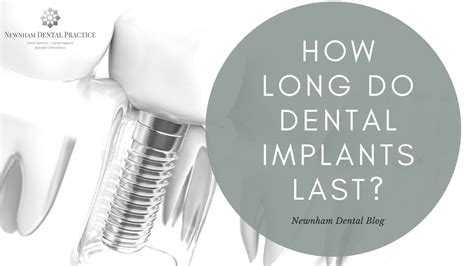 How Long Do Dental Implants Last Newnham Dental