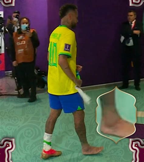 Neymar afastado Entorse no tornozelo de atacante da Seleção Brasileira