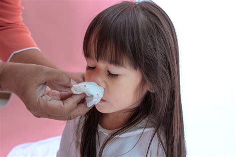 Nosebleeds In Children Paediatric Medicine Healthway Medical