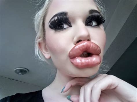 World S Biggest Pussy Lips Telegraph
