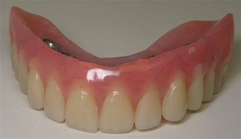 Upper Mini Dental Implants Dentures Find Local Dentist Near Your Area